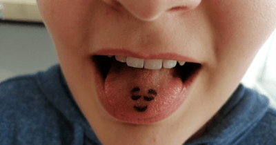 Man sieht eine Zunge mit dem Abdruck eines Zuckersmileys.